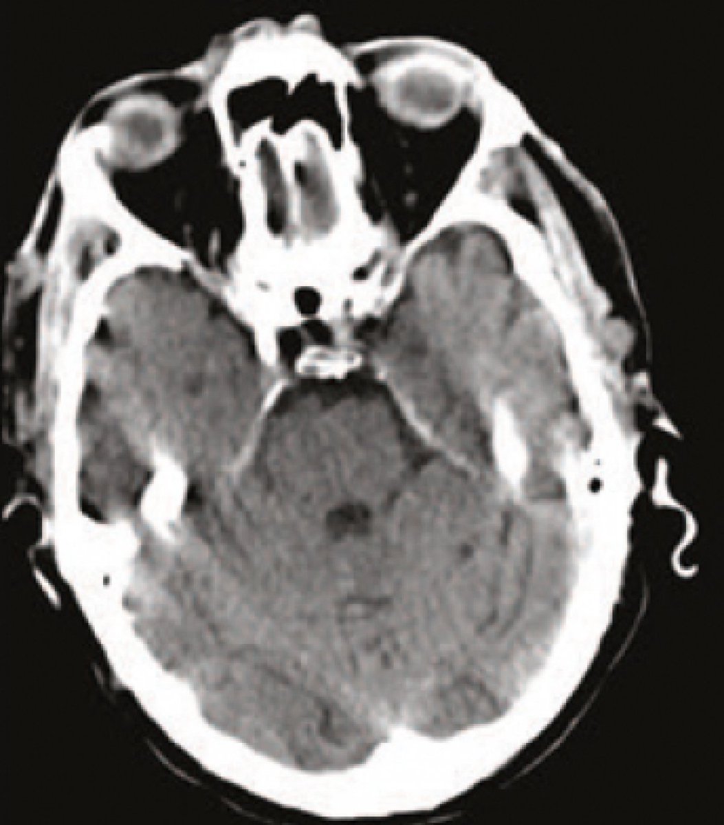 interventionnel's tweet photo. Un patient, des complications https://t.co/TE5Q5FjoDn https://t.co/N3eQM1strj