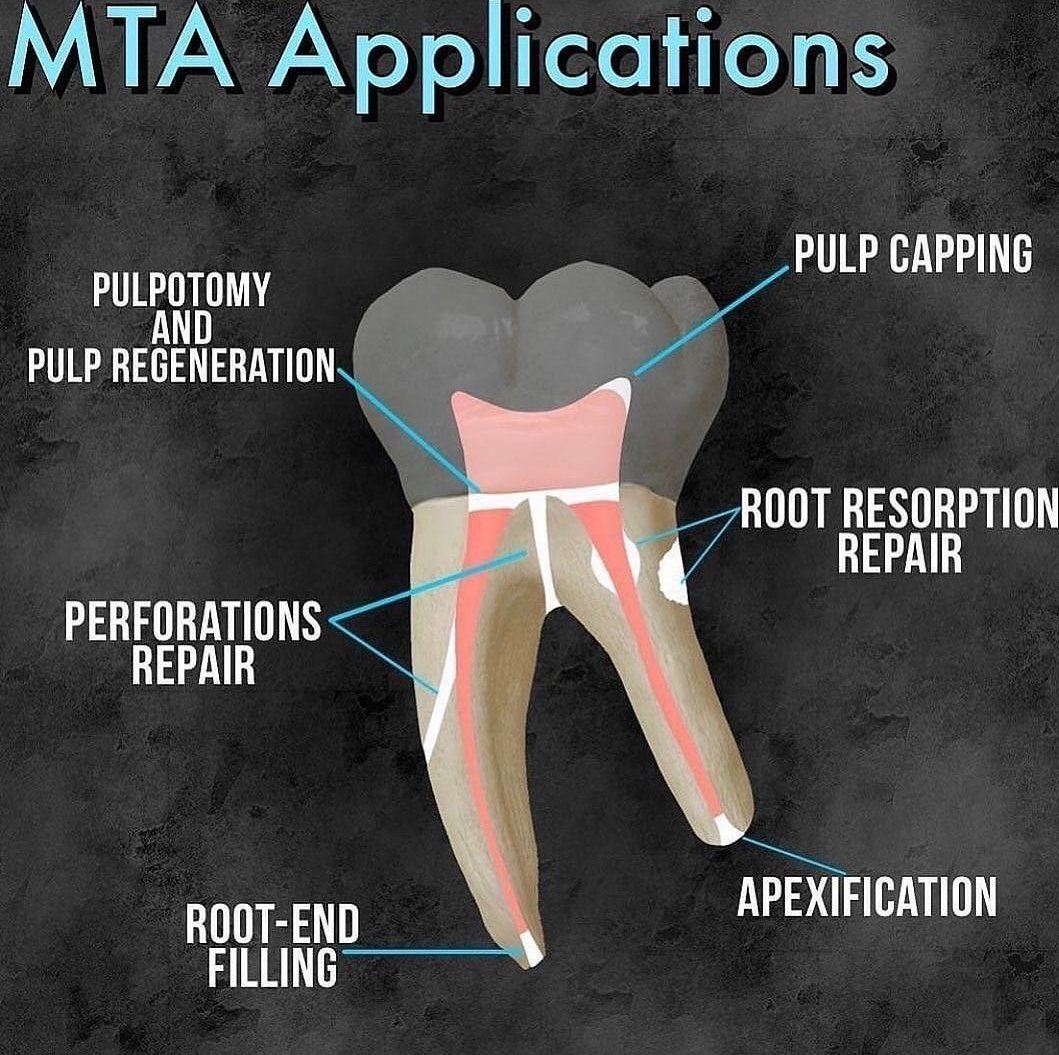 DentistWay's tweet photo. MTA Application

#dental_student https://t.co/eR5QrgIi7o