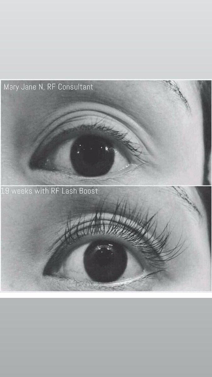 KarenRoedding's tweet image. Beautiful longer looking, fuller looking, natural lashes can be yours! 🙌

This stuff REALLY WORKS! 🌟

Message me for more details. 
I can hook you up with the goods!

#rodanandfields #KarenRoeddingRF #lashboost #naturallashes #keratin #biotin #peptides #lashes