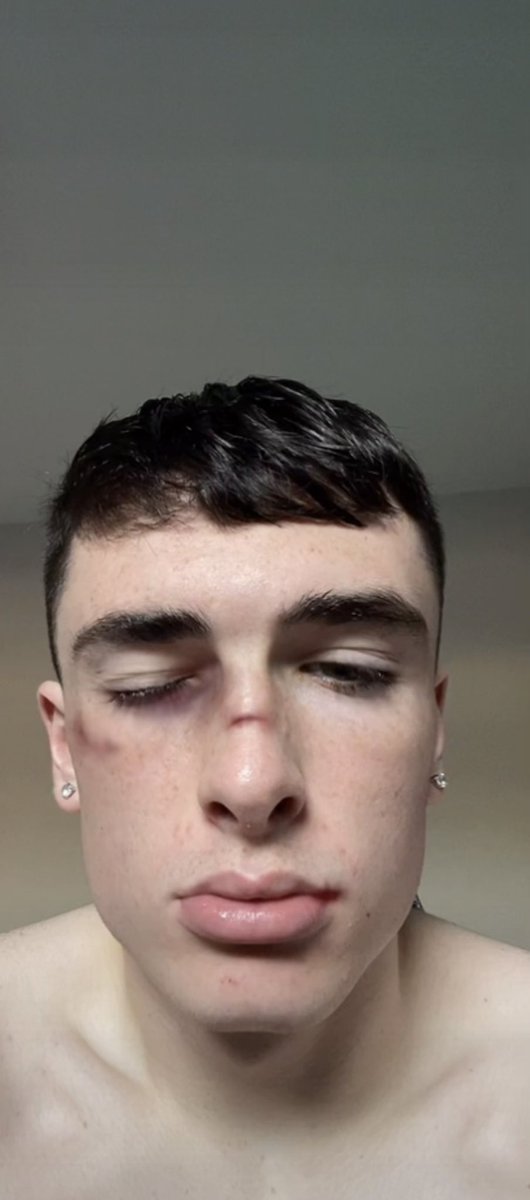 kyleDlegend tweet media
