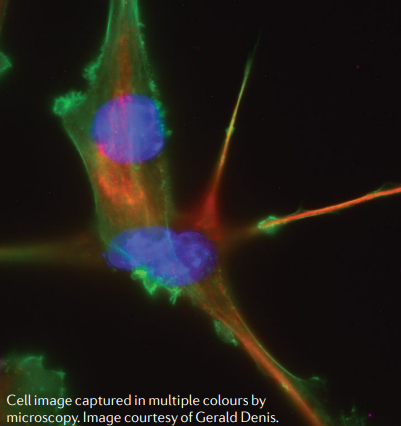 Research highlight: Adipocyte-derived exosomes may promote breast cancer progression in type 2 #diabetes
go.nature.com/3ExVIr7
 <a href="/NaserJafari26/">Naser Jafari</a> @kolla284 <a href="/ancasey8/">Allie Casey</a> <a href="/bellapompa/">Bella Pompa</a> <a href="/cs_ennis/">Christina Ennis</a> <a href="/CarlaMBoston/">Dr Carla Mazzeo MSc, PhD</a> <a href="/Nabil_Rabhi1/">Nabil Rabhi</a> <a href="/StephenRFarmer1/">Stephen R Farmer</a>
 <a href="/GdenisBoston/">Gerald Denis</a>
