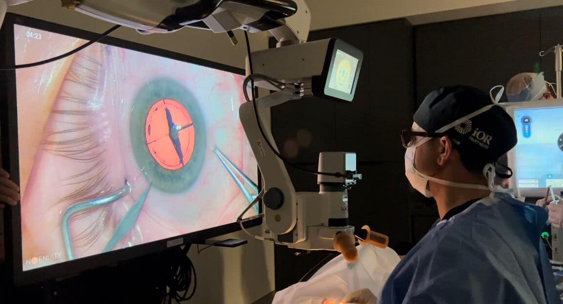 OVOLASIKLENS's tweet photo. The first in-office cataract surgeries performed in the state of MN. With Dr. Mark Lobanoff leading the team. No more hospitals/large surgery centers, 4 hr surgery times or general anesthesia. Our patients deserve only the very best! #OVO #cataractsurgery #ICL #innovation https://t.co/ug8gGXOHEb