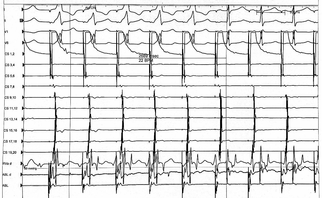 Marvin Lu tweet media