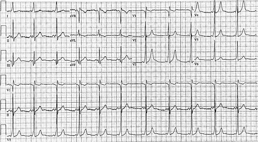 Marvin Lu tweet media