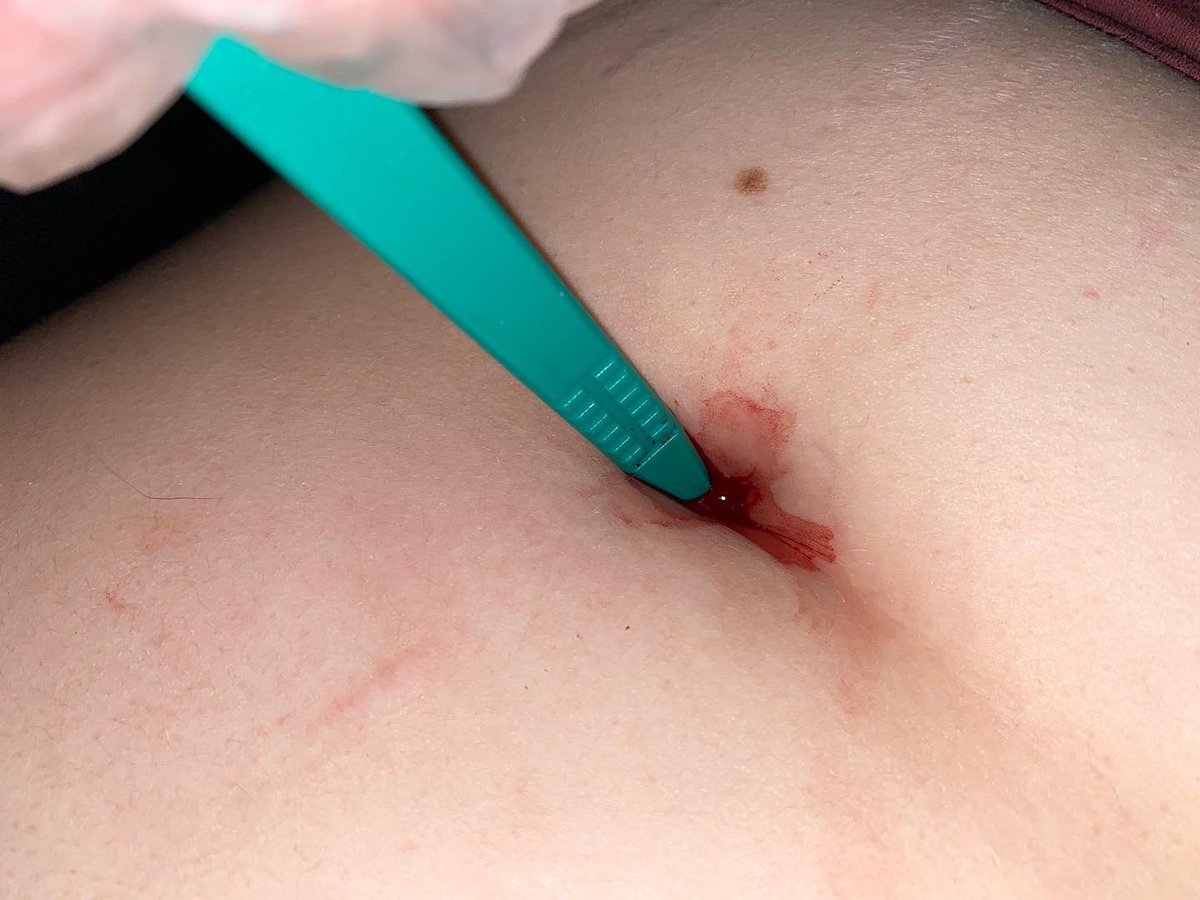 QuestionsThings's tweet photo. Navel Torture/Stab with Scalpel https://t.co/o46iv6UlnU