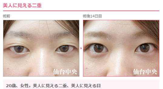美人に見える二重 Twitter Search Twitter