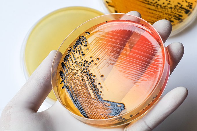 OfAdvances's tweet photo. Enhancing rapid microbiology methods: how AI is shaping microbiology https://t.co/nNUv4YrTn3 
#Alsb https://t.co/NzY1jCUC7l