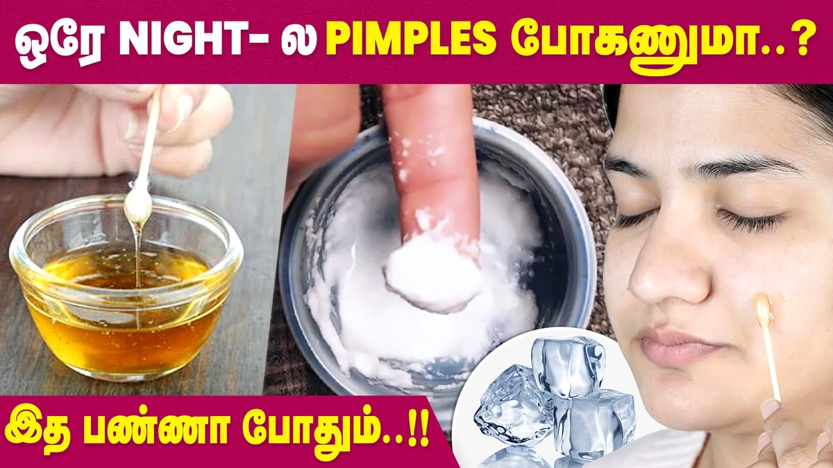 IbcMangai's tweet image. Home Remedies to get rid of Pimples Overnight | Skin Care | IBC Mangai

VIDEO --&amp;gt; youtu.be/Bosy-sls5DQ

#Pimples #Skincare #PimplesRemoval #SkincareTamil #IBCMangai
