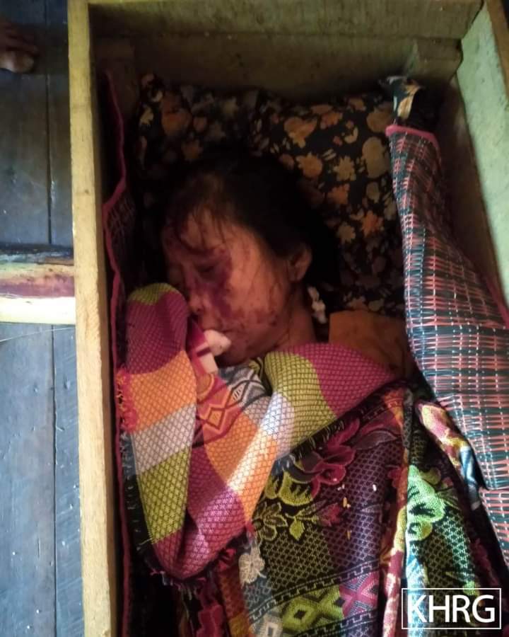 spring_2021's tweet photo. TW//Death

On Dec21,NawKhi who farming with her husband in NoBelBaw village tract, DuTaTu District,Belin Tsp, Karen State,was abducted, tortured and shot dead by SAC. She was abducted after their couple split and fled as shooting between SAC and KNLA near their farm.

#Dec23Coup https://t.co/gzkux5UpEf