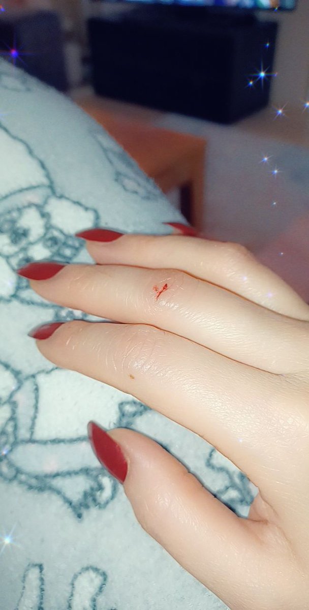 ادعولي قوم بالسلامه نزفت كتير 😢...