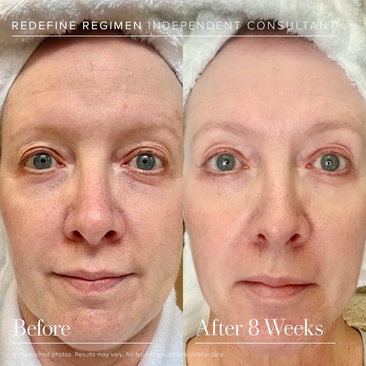 AmyKByrd's tweet photo. My friend Linda's results are amazing!!
#TeamByrd #greatskinisalwaysin #SPFyourself #youreworthit #hellobeautiful #skinitsabeautifulthingwearitwell #takecareofyou https://t.co/eyZUGZNWXm