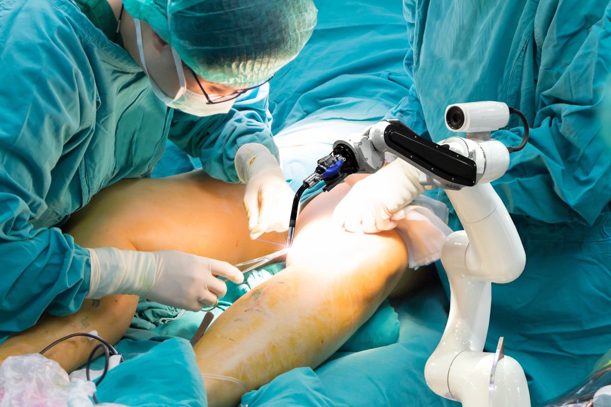 interventionnel's tweet photo. Qu’attend-on pour déployer des programmes RAAC en chirurgie vasculaire périphérique ? https://t.co/D6JlHfENqX https://t.co/cKn0hbnXcS