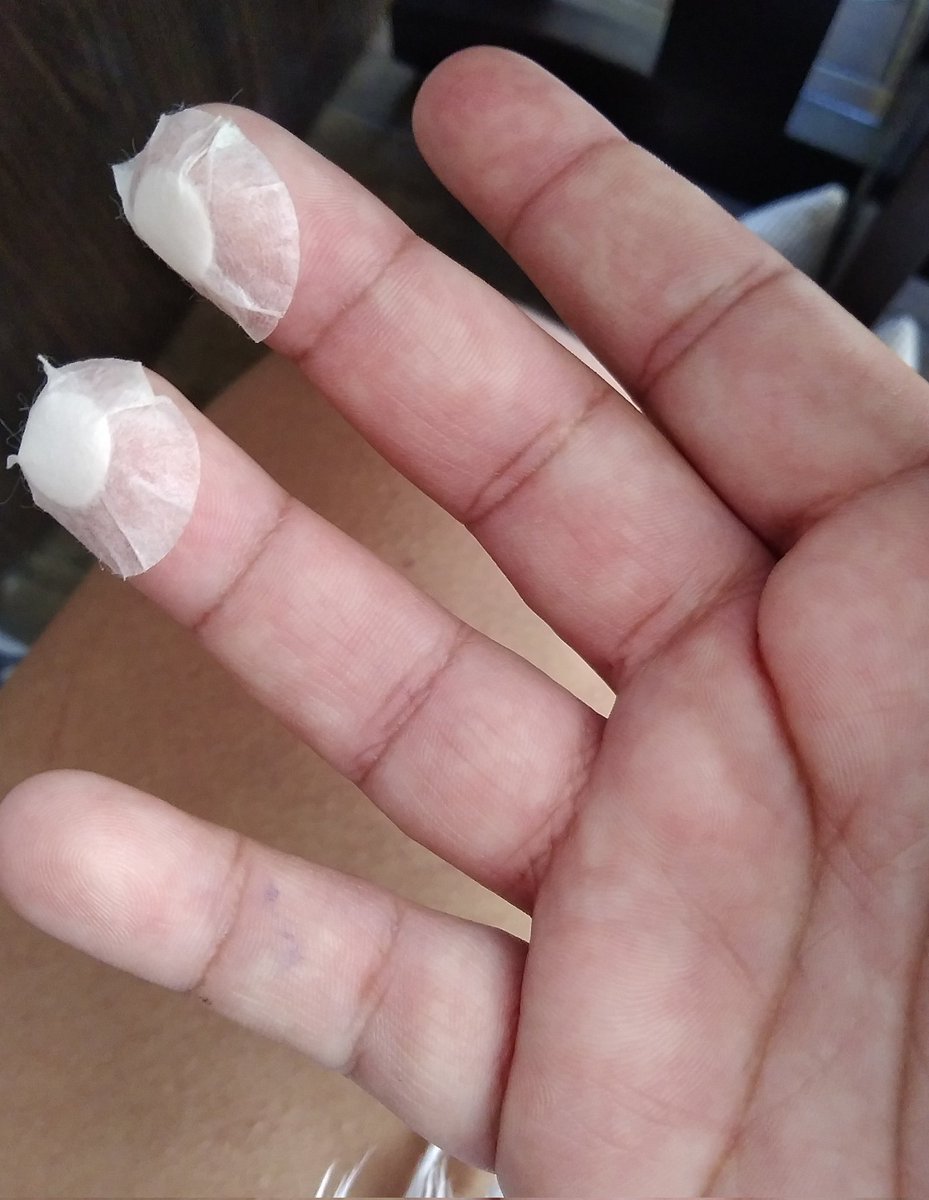 kimbumbrazil's tweet image. OFF: É com muita dor no coração que venho dizer que a Ademira aqui não vai poder participar do #GhostDoctorProject
Pra quem n sabe quando se vai doar sangue eles fazem um teste no seu dedo, infelizmente a minha hemoglobina e meu índice glicêmico estavam abaixo do normal agora +