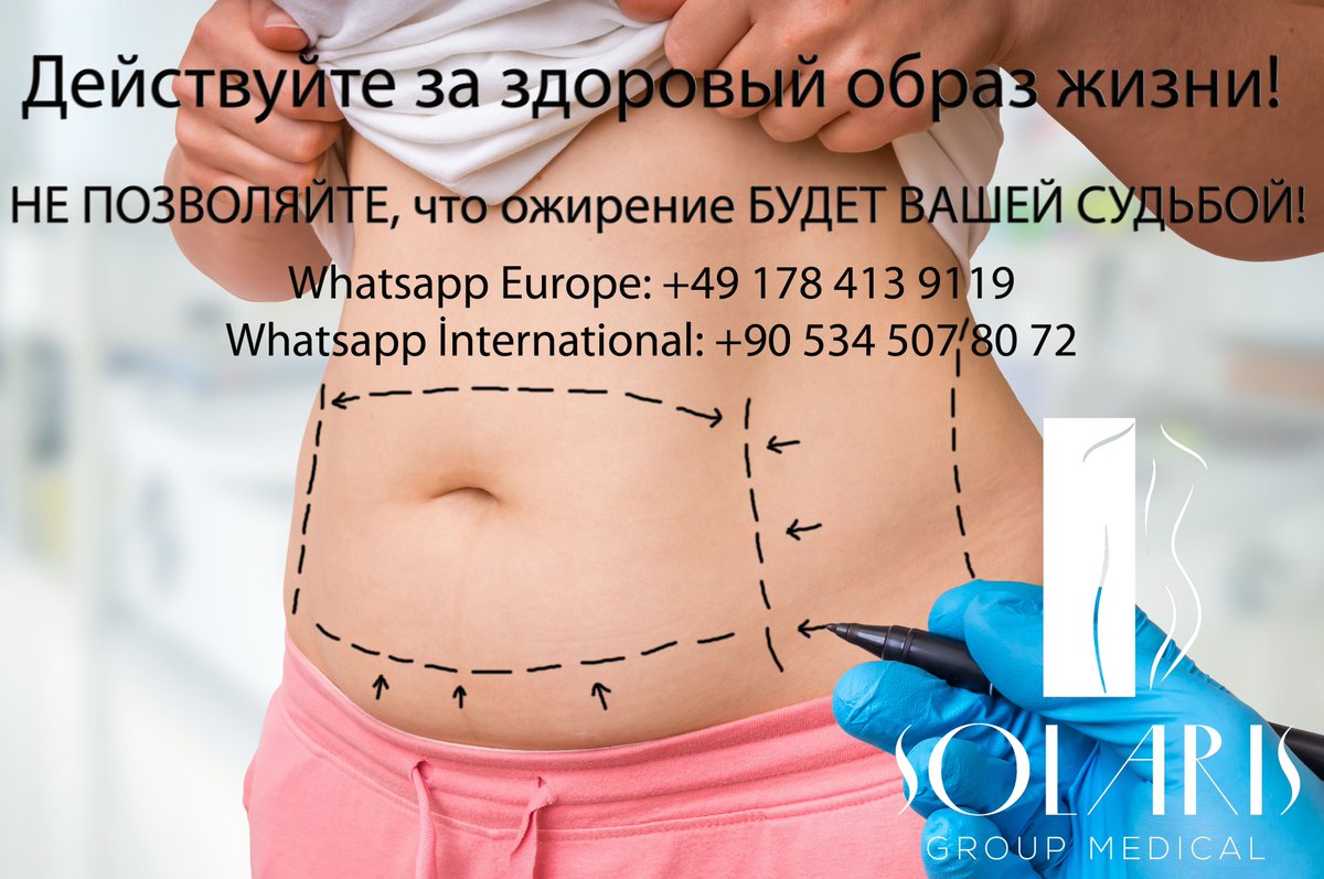 Solaris_Medical's tweet photo. # ожирение # хирургия ожирения # хирургия ожирения # медицинский туризм # медицинский туризм # медицинский туризм # медицинский туризм # гастроинтерактивный обход # желудочный обходной анастомоз # гастрохирургия https://t.co/GwU5Y92O3U