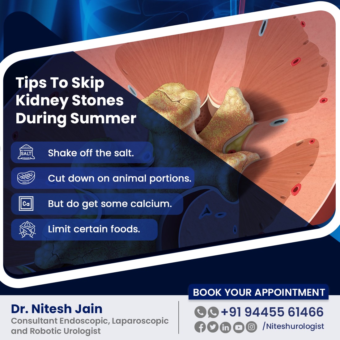 niteshurologist's tweet photo. You don't have to add salt to your food to eat too much of it – around 75% of the salt we eat is in everyday foods we buy, such as bread, breakfast cereal and ready meals.
#salt #saltintake #reducesaltintake #dietplan #practicehealthydiet #urology #savekidney https://t.co/Nue53nP3N4