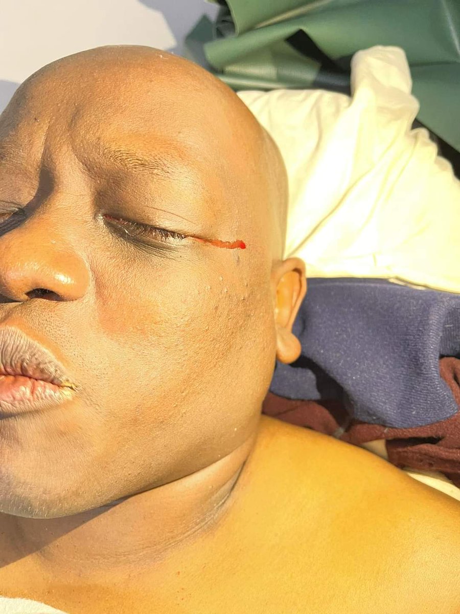 Dennis Itumbi sheds tomatoes instead of tears. Usicheze na Alibaba school of PR 🤣🤣🤣🤣