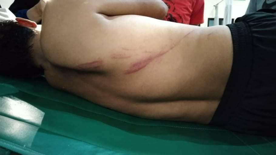 Wasit yg memimpin pertandingan ini harus dilarikan ke rumah sakit akibat luka pukul di bagian wajah. 

Menunggu tanggungjawab Asprov PSSI Sulsel atas berbagai kericuhan yg terjadi di Liga 3 Zona Sulsel sejak awal hingga masuki putaran final saat ini