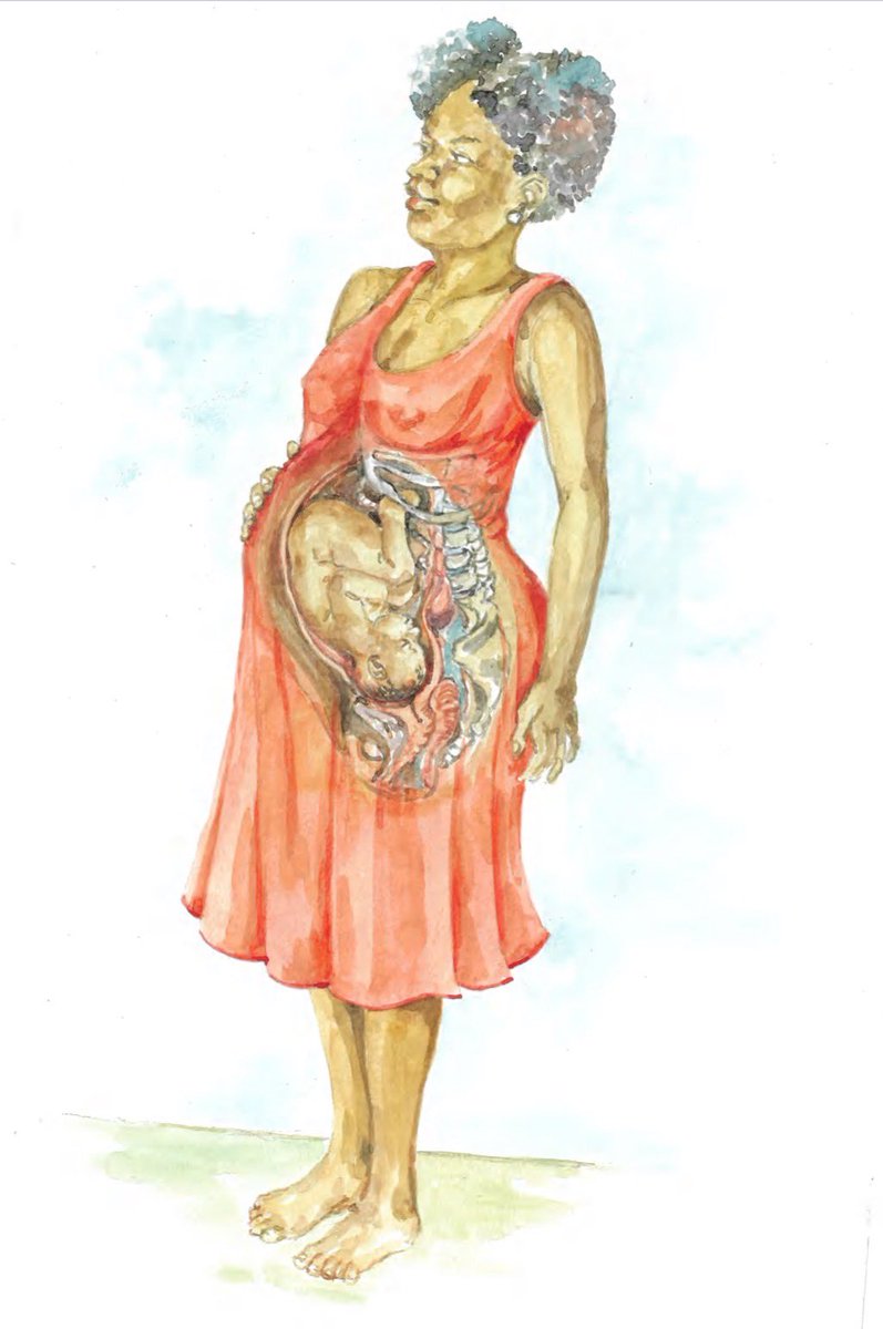 Ik heb een kinderboek geschreven!
Weet jij wat het wordt? helpt kinderen om te begrijpen wat er met hun moeder gebeurt tijdens een zwangerschap, in het bijzonder wanneer er sprake is van een complicatie als Hyperemesis gravidarum.

#kinderboek #hyperemesisgravidarum #zwangerschap