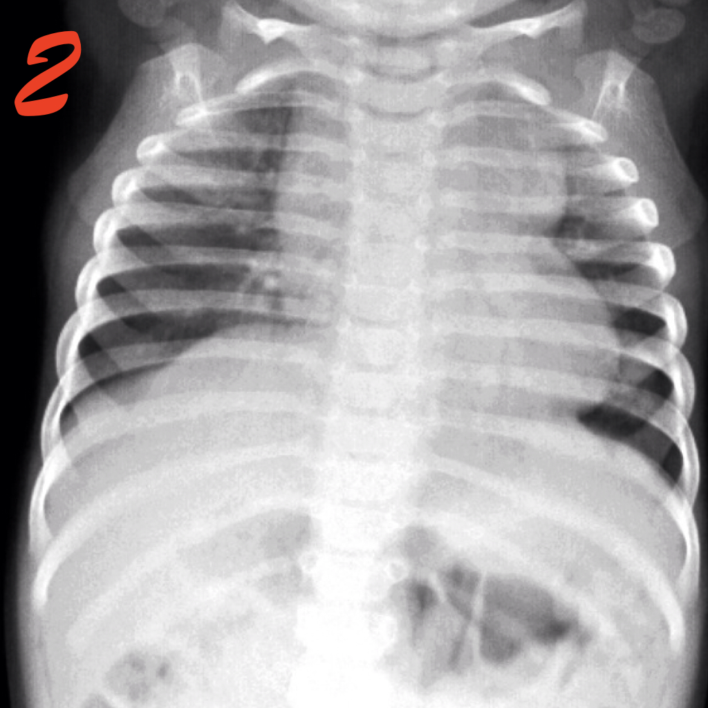 Dr Vikas Shah tweet media