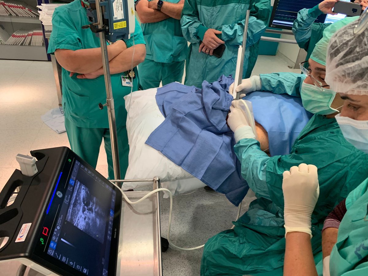 First implants of Javelin by <a href="/DvirDanny/">Danny Dvir</a> and team. US guided direct bilateral carotid permanent implantation to prevent stroke. Patient going home several hours after. Another field for interventional cardiology?
