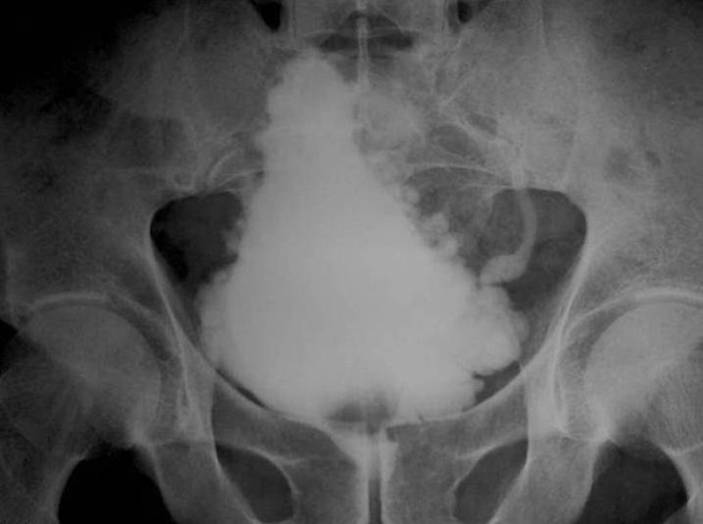 mernstUro's tweet photo. It’s #FellowshipFriday!

I think the Christmas Tree Bladder has had the spotlight for long enough. So, I’d like to suggest a few new holiday themed bladders 🤷‍♀️ 

Peds uro fellows: any other? 🤨

Hope everyone has a wonderful holiday! https://t.co/mmXCCXoTXX