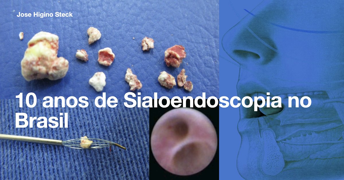 higinosteck's tweet photo. Sialoendoscopia 10 anos no Brasil https://t.co/5InEHUqQTM https://t.co/gEw807BXMu