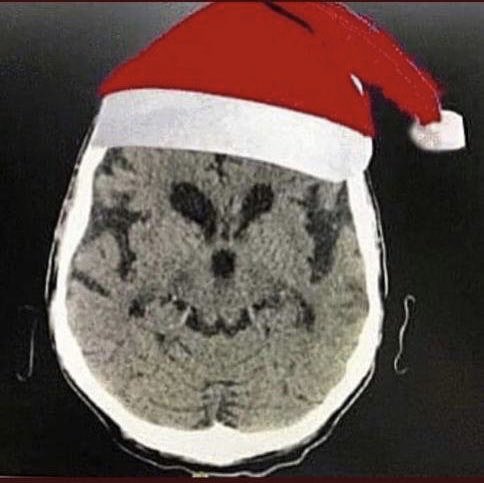 Imagen cardio (@imagencardio) on Twitter photo Even the Grinch wants to wish you Merry Christmas this year!!! <a href="/ImagenCardiaca/">SEIC - Sociedad Española de Imagen Cardíaca</a> <a href="/SERAM_RX/">SERAM - Sociedad Española de Radiología Médica</a> <a href="/residentesSERAM/">Residentes SERAM</a> <a href="/sediabdomen/">SEDIA</a> <a href="/GuzmnNy/">Gabriela Guzmán</a> <a href="/ElenaRefoyo/">Elena Refoyo</a> <a href="/purviparwani/">Dr. Purvi Parwani</a> <a href="/LopezOpitz/">J.Lopez-Opitz@CardioImagen_cl</a> <a href="/danilorenzatti/">Daniel Lorenzatti, MD.</a> Even the Grinch wants to wish you Merry Christmas this year!!! <a href="/ImagenCardiaca/">SEIC - Sociedad Española de Imagen Cardíaca</a> <a href="/SERAM_RX/">SERAM - Sociedad Española de Radiología Médica</a> <a href="/residentesSERAM/">Residentes SERAM</a> <a href="/sediabdomen/">SEDIA</a> <a href="/GuzmnNy/">Gabriela Guzmán</a> <a href="/ElenaRefoyo/">Elena Refoyo</a> <a href="/purviparwani/">Dr. Purvi Parwani</a> <a href="/LopezOpitz/">J.Lopez-Opitz@CardioImagen_cl</a> <a href="/danilorenzatti/">Daniel Lorenzatti, MD.</a>