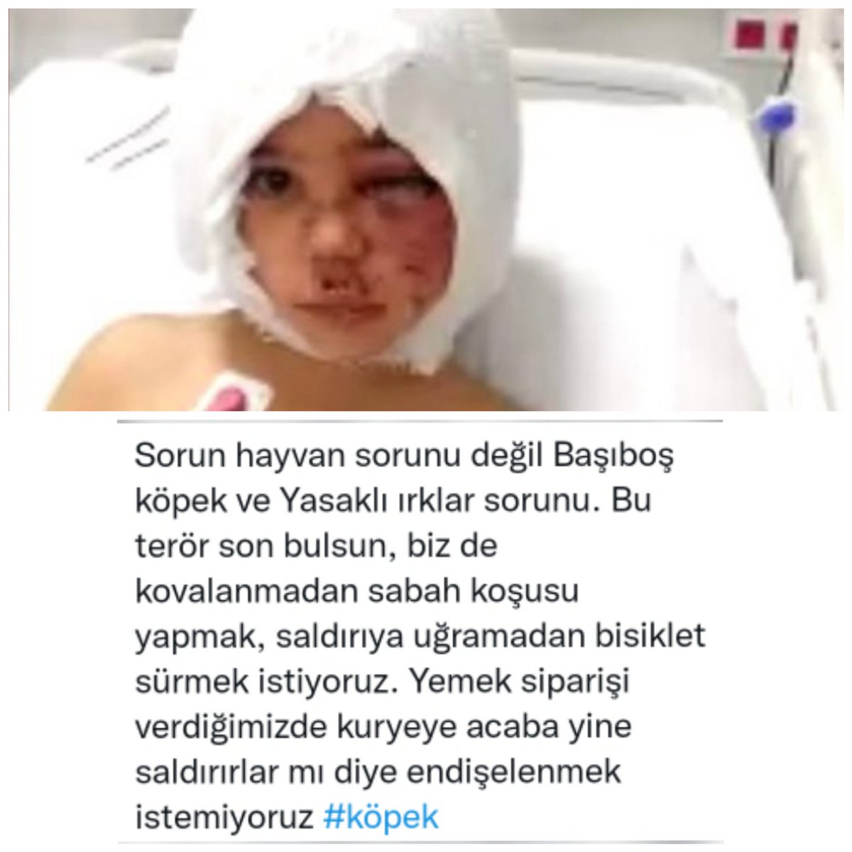 ersin_mert5's tweet photo. #Asiye #pitbullyasaklansin #sustular https://t.co/hKLHB3RxGv