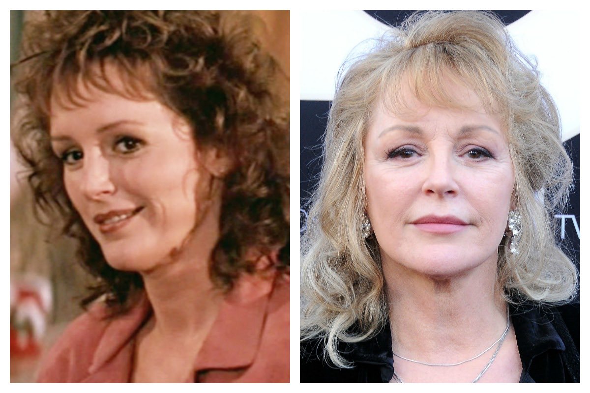 Bonnie Bedelia Facelift