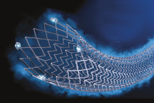 interventionnel's tweet photo. L’étude randomisée contrôlée EMINENT - La supériorité du stent actif Eluvia™ par rapport au stent nu pour les lésions fémoropoplitées https://t.co/90ncrxH7GS https://t.co/7nlaDfgyEw