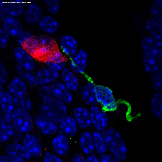 In mice, IL-25 and CysLTs proteins from airway #TuftCells cooperate to drive #Allergen inflammation in the lungs, say <a href="/BrighamWomens/">Brigham and Women's Hospital</a> <a href="/HarvardMed/">Harvard Medical School</a> researchers. fcld.ly/o32j3u4