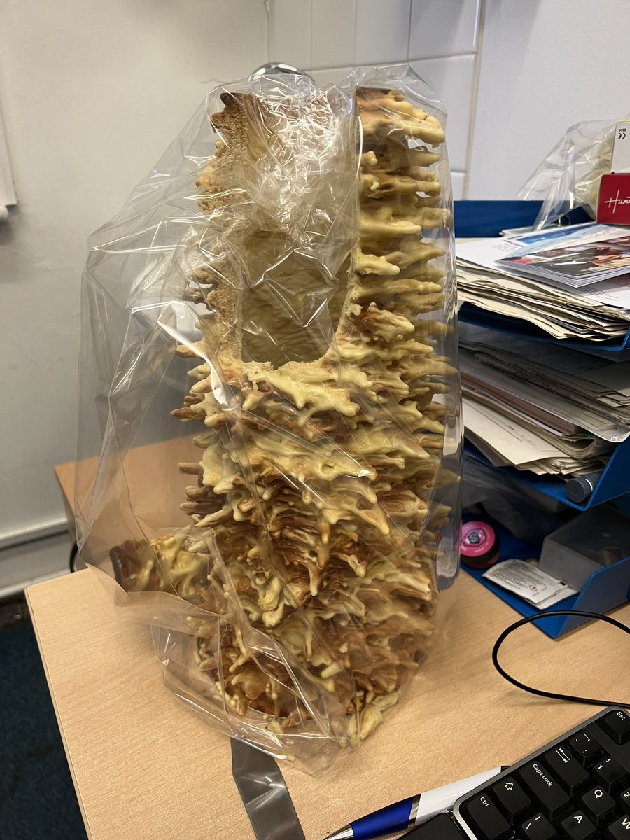 Saurabh Chaudhri (@drschaudhri) on Twitter photo Entrapment! Sweet edible Christmas cake- offered by an equally sweet diabetes team😇@WhippsCrossHosp <a href="/kmajumdar2015/">Kalpita Majumdar</a> <a href="/NHSBartsHealth/">Barts Health</a> Entrapment! Sweet edible Christmas cake- offered by an equally sweet diabetes team😇@WhippsCrossHosp <a href="/kmajumdar2015/">Kalpita Majumdar</a> <a href="/NHSBartsHealth/">Barts Health</a>