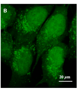 RBResearchTeam's tweet image. Cordycepin-loaded PLGA nanoparticles (CPNPs) are an encapsulated drug for cancer treatment that exhibited a high level of cellular uptake and cytotoxicity 3 times lower than the free drug in MCF-7 cells. (Marslin et al., 2020)
Source: doi.org/10.2147/NSA.S2…
Shared by: Khairun