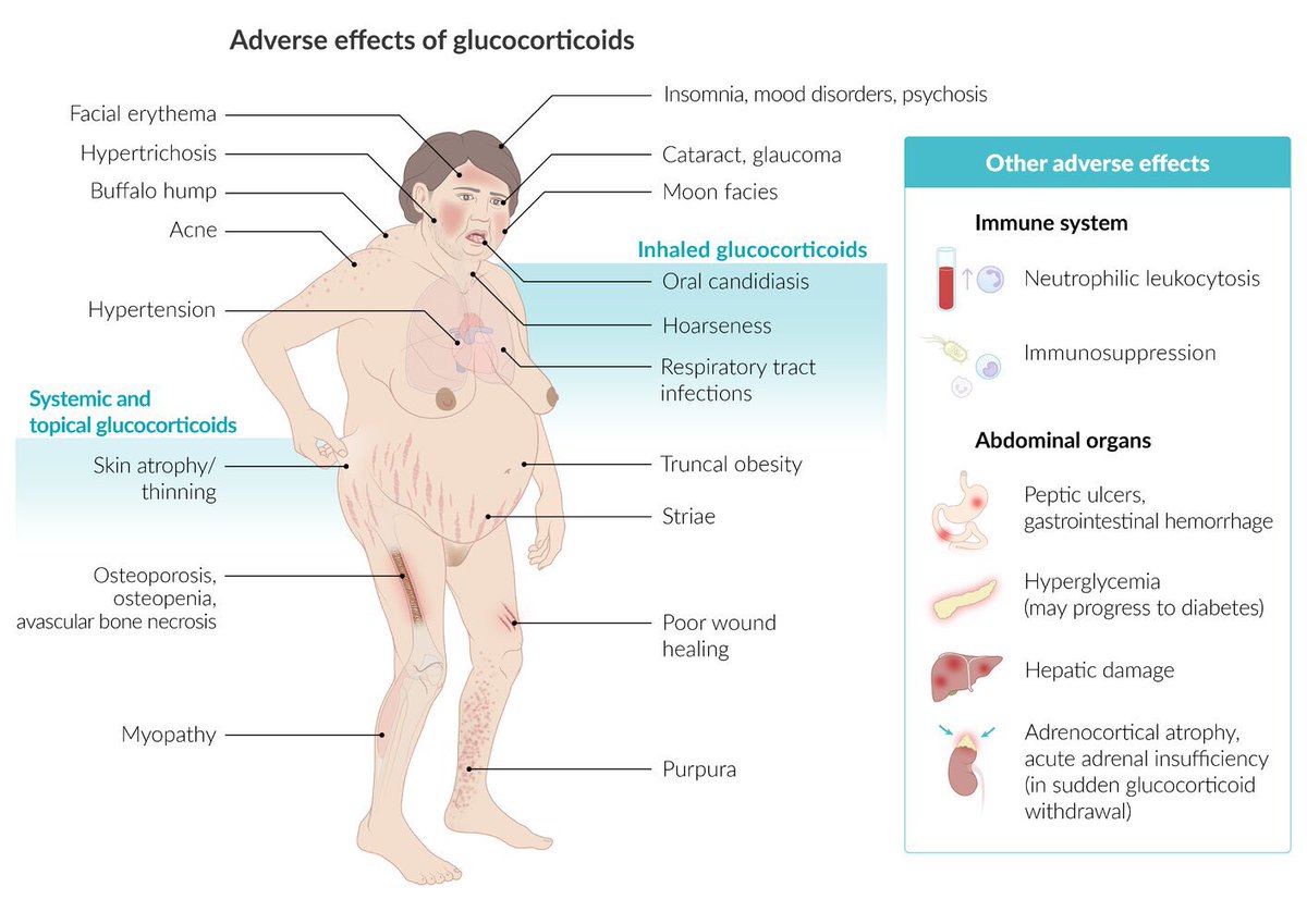 DailyPharmacist's tweet photo. CORTICOSTEROID ADVERSE EFFECTS

💧 Mineralocorticoid effects:
 Hypertension
 Sodium &amp; water retention
 Potassium loss
 Calcium loss

💪🏼 Glucocorticoid effects:
 Diabetes
 Osteoporosis
 Muscle wasting

⚠️ May also cause psychiatric reactions &amp; are linked to peptic ulcers https://t.co/voi2jRw8vy