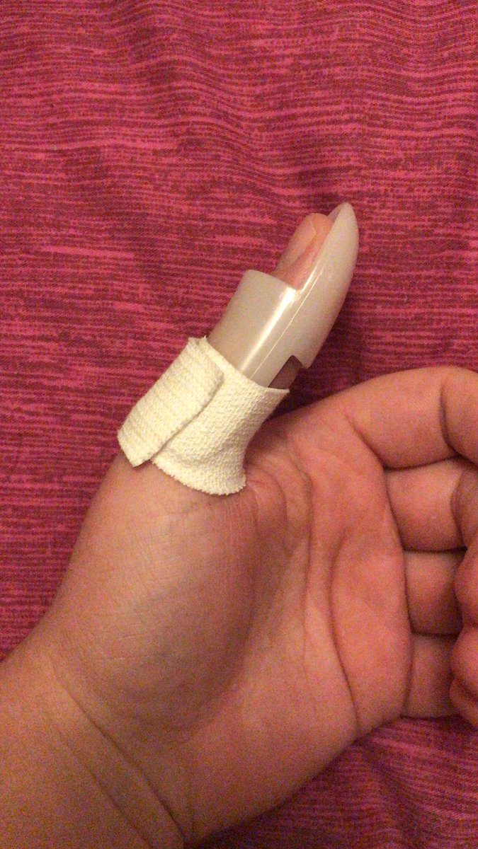 LozJ1992's tweet photo. Merry Christmas everyone! 🎉 I wish everyone a fantastic time!! To all that are working, I hope you manage to get some form of Xmas dinner!!! 
I managed to avoid working today, by fracturing my thumb at work last night…at least I’ll be great at hitchhiking for a while 🤣🤣 https://t.co/39DxPHuwW1