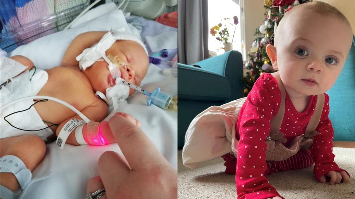 RMHCUK's tweet photo. Happy birthday Beth! 🎂

Beth was born on #ChristmasDay last year with a very rare condition. Her family from Edinburgh found themselves seeking specialist medical care in Manchester. Luckily, our Ronald McDonald House was there to help.

Read more: https://t.co/hFAgBmNw95 https://t.co/y9dvPe2kpC