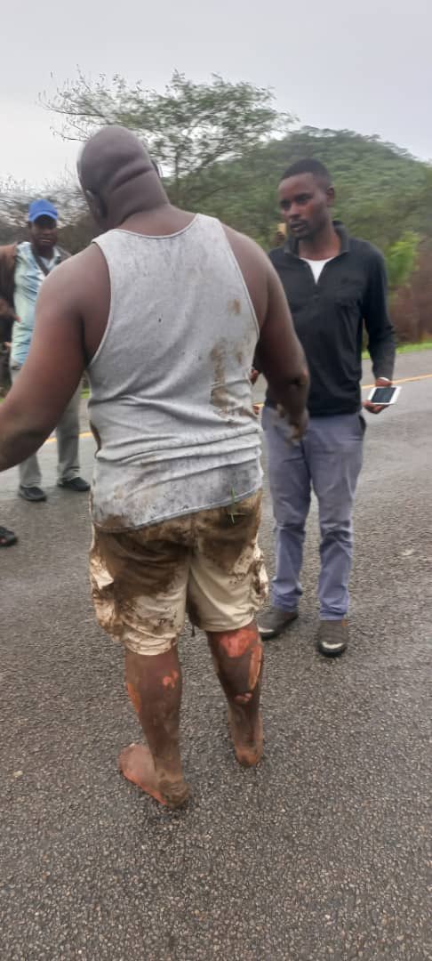 I have read the story of a truck driver who saved lives at yesterday’s tragic bus &amp; truck accident on Mutare Road.

Sirizani Butau is the definition of a real Zimbabwean hero.

He should walk into any private health facility and be treated for his wounds sustained whilst helping.