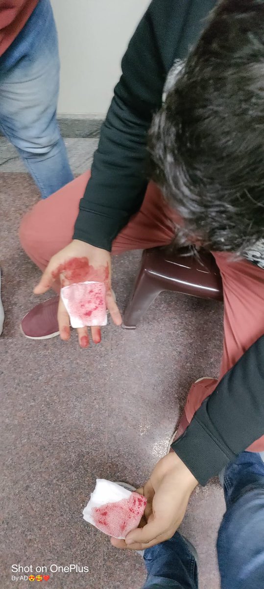 कुछ लोगो ने मुझको शाम में चोट पहुंचाई है हमला कर 3 लोग थे इतनी राजनीति गिर जाएगी कभी सोचा नहीं था । <a href="/sirakashdwivedi/">आकाश द्विवेदी</a> @buntypandey99 <a href="/Ajitsonkar04/">अजीत कुमार सोनकर</a> <a href="/mayankshukl1/">MayankShukla Su</a> <a href="/nishabdBatein02/">Nidhi Singh_Su</a>