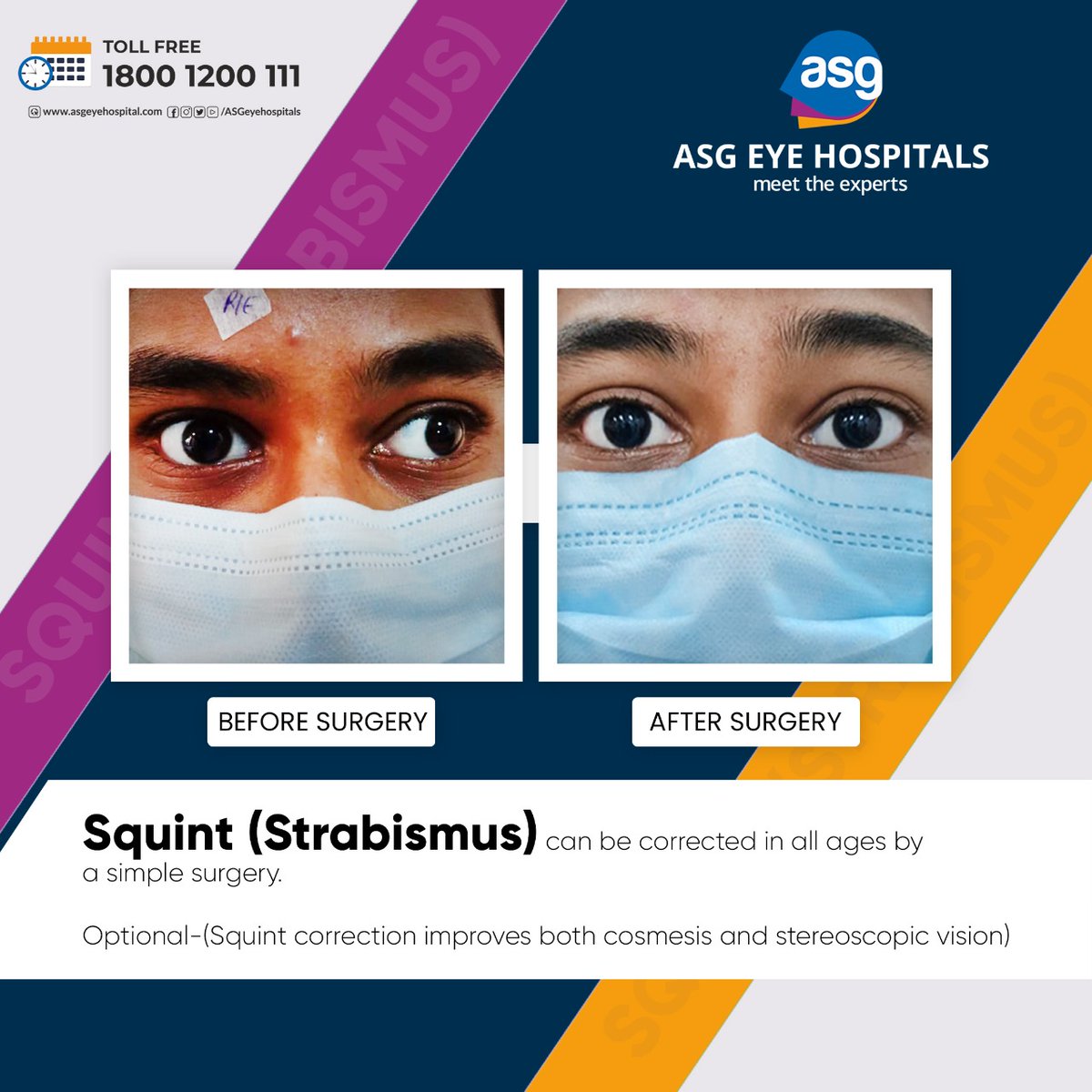 ASGEyeHospitals's tweet photo. Squint (Strabismus) can be corrected in all ages by a simple surgery.
Optional-(Squint correction improves both cosmesis and stereoscopic vision)
For appointment call 1800 1200 111 Toll free.
#asgeyehospitals #asgeyecare #eyetreatment #squint #squintsurgery #squinttreatment https://t.co/XRQ44FHFdv