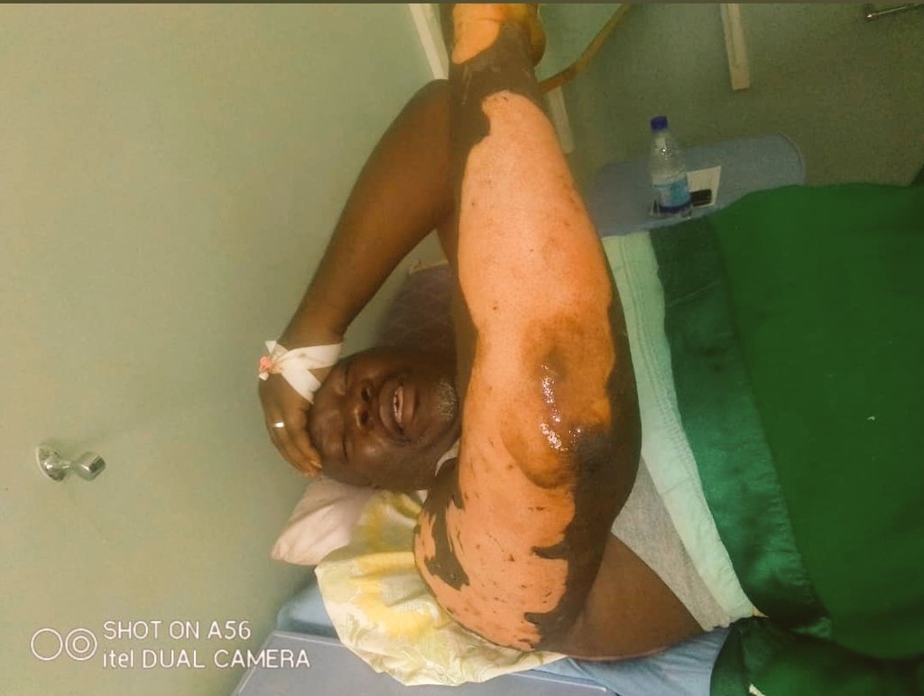 VZimbabwe's tweet photo. 😭😭😭😭 our Zimbabwean hero Surizani Batau now in Hospital getting injuries sustained during a rescue operation he bravely carried out in mutare. Retweet Retweet Retweet 
Here with his eco cash number supplied  by Zim eye. God bless him we salute you Sir   +263773024849 https://t.co/awYwEnZTXR