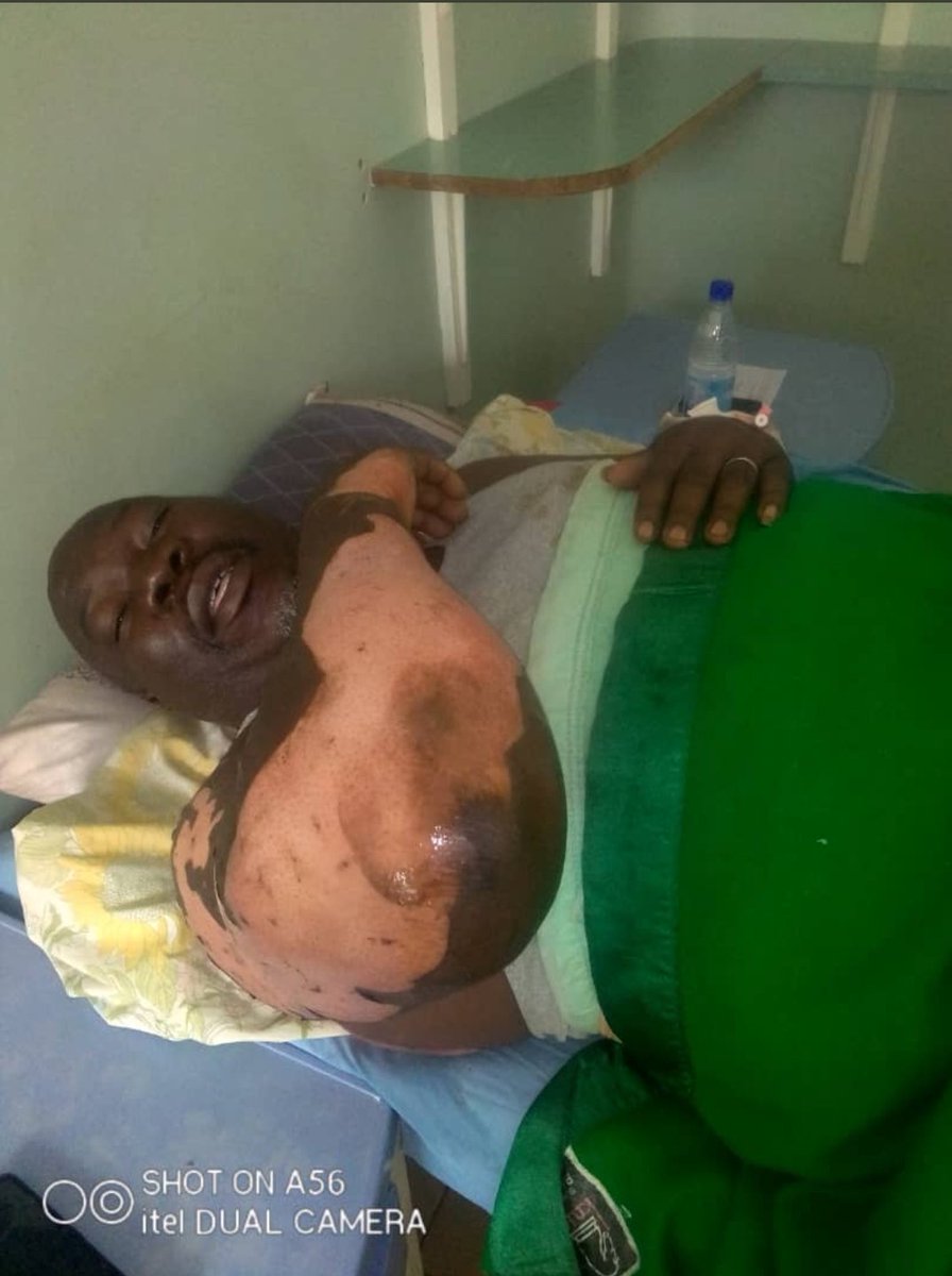 VZimbabwe's tweet photo. 😭😭😭😭 our Zimbabwean hero Surizani Batau now in Hospital getting injuries sustained during a rescue operation he bravely carried out in mutare. Retweet Retweet Retweet 
Here with his eco cash number supplied  by Zim eye. God bless him we salute you Sir   +263773024849 https://t.co/awYwEnZTXR