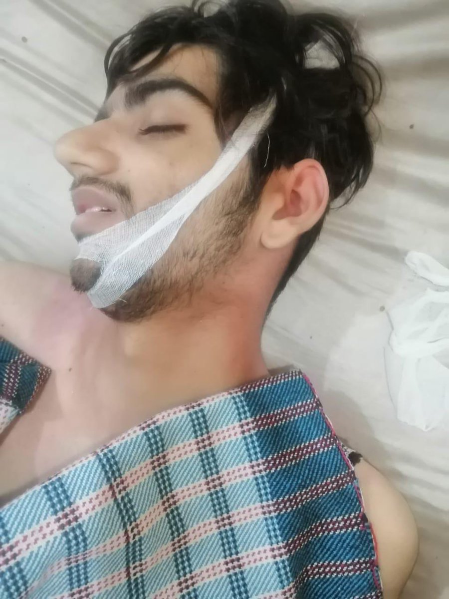 اسلام آباد میں نجی یونیورسٹی کے ہاسٹل کے واش روم میں دم گھٹنے سے طالبعلم جانبحق, واش روم میں گیزر سے لیکج کے باعث کاربن مونوآکسائیڈ گیس جمع ہوگئی تھی, سرگودھا کا رہائشی محمد عثمان سی ایس فرسٹ سمسٹر کا طالبعلم تھا، نعش  پمز اسپتال منتقل، پولیس کی جانب سے واقعہ کی تحقیقات شروع