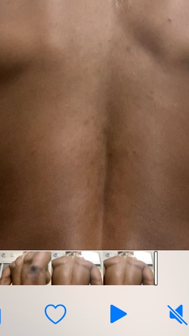 Neglecting me for 7 months  to live and currently living in infestation bitten over 9000 times at 50