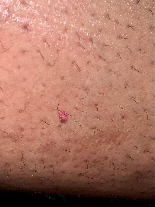 Neglecting me for 7 months  to live and currently living in infestation bitten over 9000 times at 50<a href="/tag/goddess"class="tags"><span>#goddess</span></a><a href="/tag/goddessofsex"class="tags"><span>#goddessofsex</span></a><a href="/tag/nylajackson"class="tags"><span>#nylajackson</span></a><a href="/tag/goddessofhead"class="tags"><span>#goddessofhead</span></a>