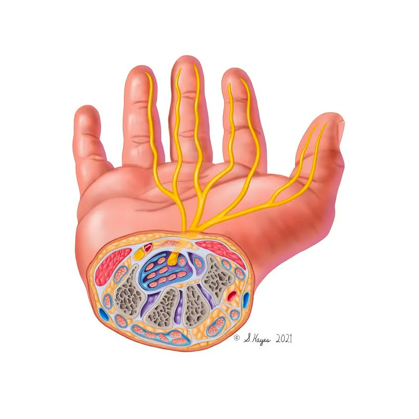 Medillustrates's tweet photo. Anatomical illustration of carpal tunnel by #SuzanneHayes, a scientific artist and medical illustrator based in Colorado. 

Explore more of her work: https://t.co/NFXa40HQWj

#carpaltunnel #nerves #handanatomy #connectivetissues #medicalillustration #scientificart #sciart #medart https://t.co/Qn8176Pg2h