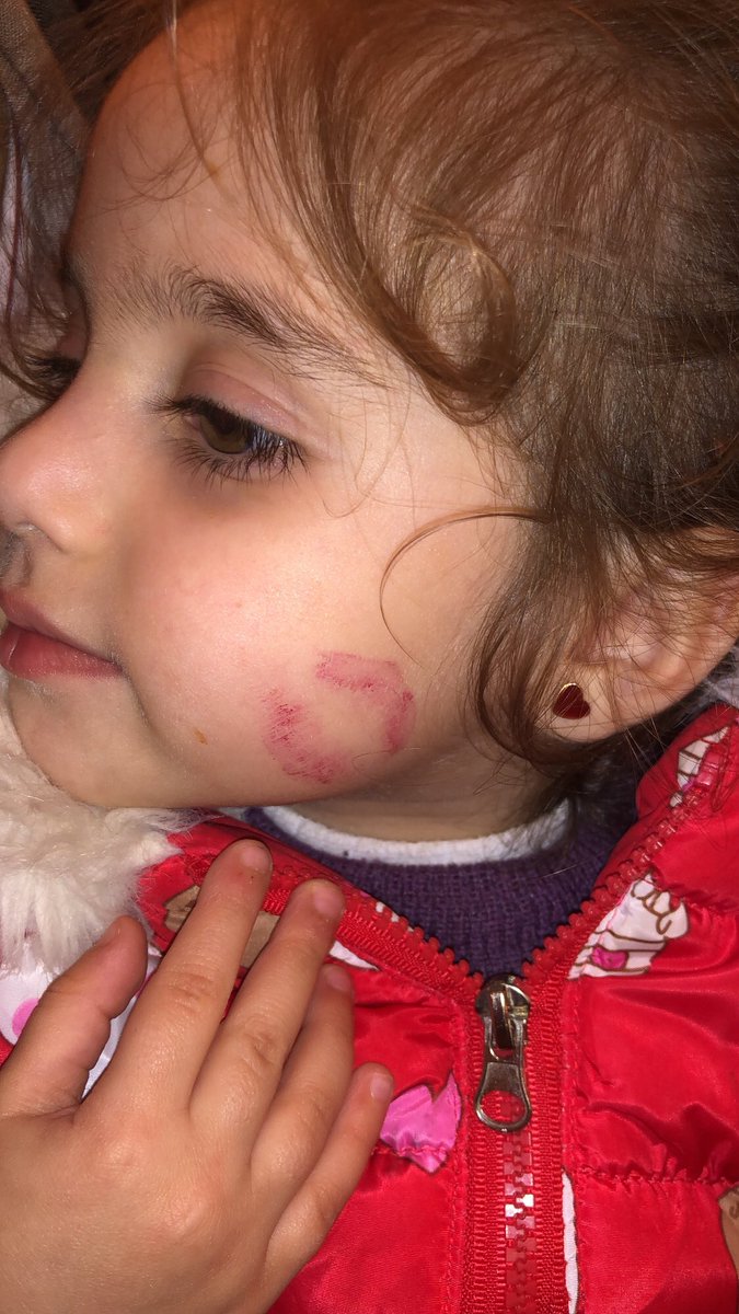 Amro_Jamous's tweet photo. My little angel, yesterday was the best day of the year. 
I couldn't imagine it better than that

Salma lipstick approved. 😜 https://t.co/9tNsO5QeXq