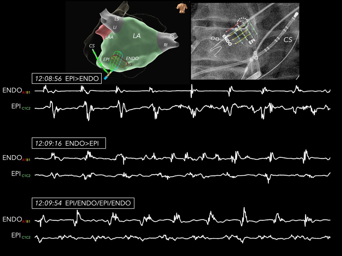 Roderick Tung tweet media