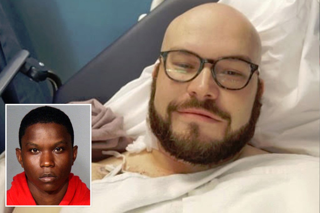 nypost's tweet image. German tourist stabbed near Columbia University is 'healing well' back home trib.al/1LjHMd6