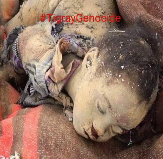 WediHayet7's tweet photo. The people of Tigray are experiencing devastating humanitarian crisis. When drone attacks and airs trikes are conducted and target public infrastructures, it destroys the little vital resources left in Tigray. @ChrisCoons @State DeptSpox #StopBombingTigray https://t.co/MWgLJjdqQ9