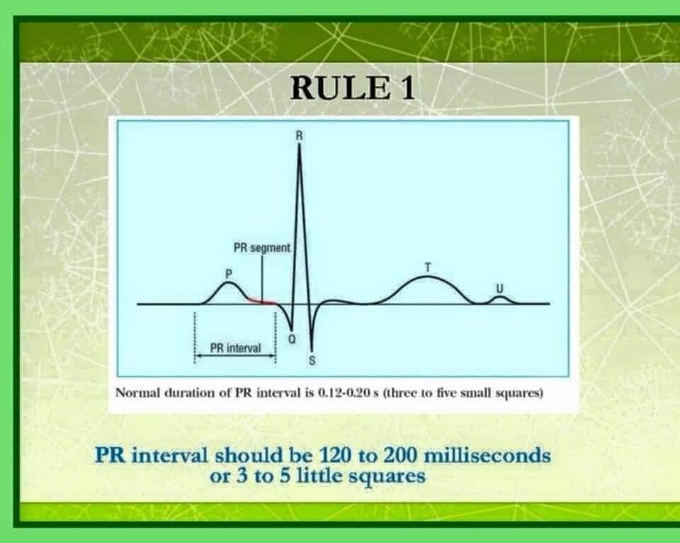 PatologCritica's tweet photo. Las 10 Reglas del Profesor Chamberlain para la Interpretación del #ECG Normal!!!
Aquí las 3 primeras Reglas!!!
Sigue el Hilo para ver las otras 7!!!
👇👇👇👇👇👇👇👇👇👇 https://t.co/iC8MWazTvT
